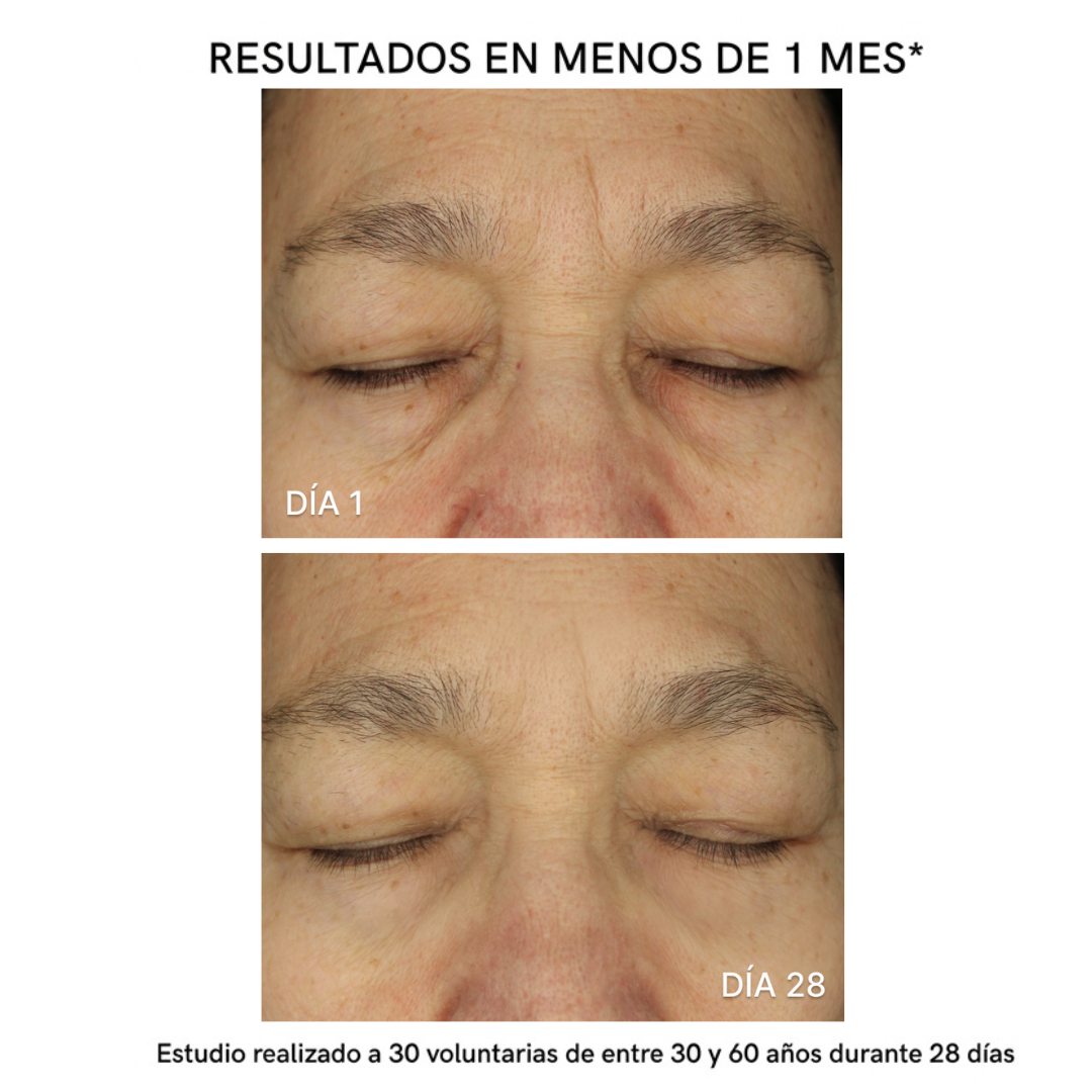 Parches MicroAgujas + Ácido Hialurónico y Colágeno