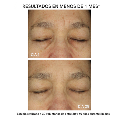 Parches MicroAgujas + Ácido Hialurónico y Colágeno